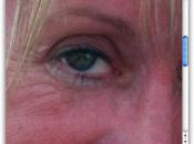 Banishing bags 'n blemishes